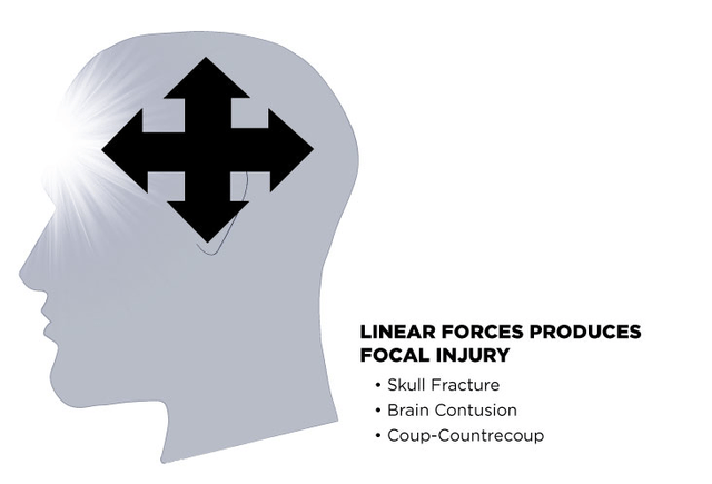 Why You Should be Riding in a Full Face Helmet