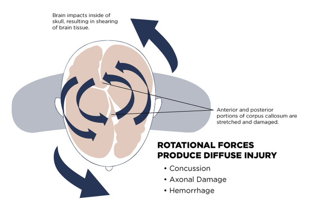 Why You Should be Riding in a Full Face Helmet