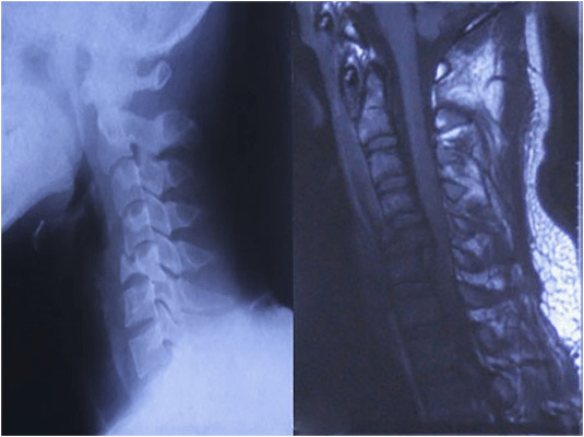 Why You Should be Riding in a Full Face Helmet